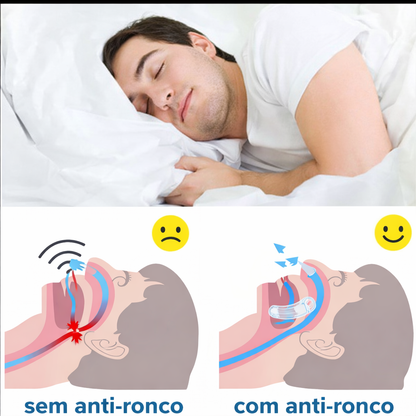 SonoAlign™ Anti-ronco bucal de TPE (Material macio)