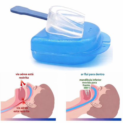 SonoAlign™ Anti-ronco bucal de TPE (Material macio)