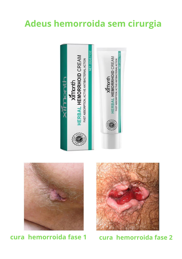HemoRelief™-Creme para hemorroidas