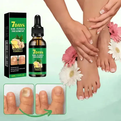 FungoClean™-Removedor de fungos nas unhas