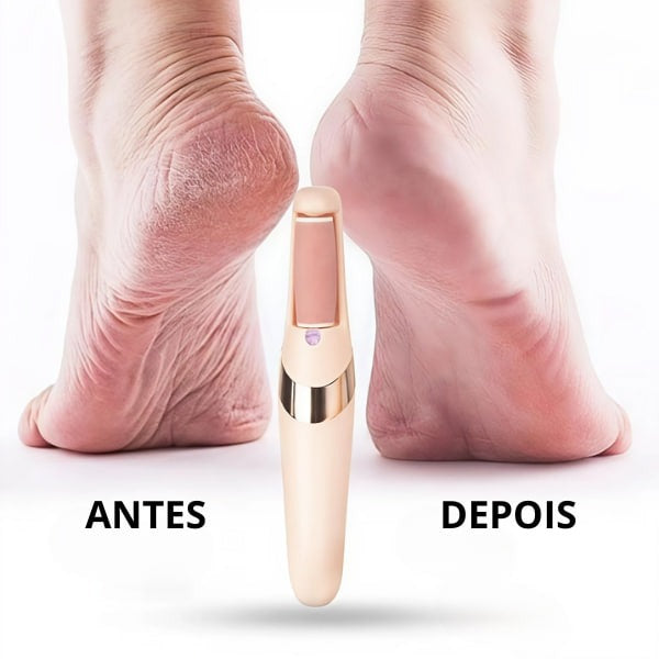 FootCure Pro™-Lixadeira elétrica para calos